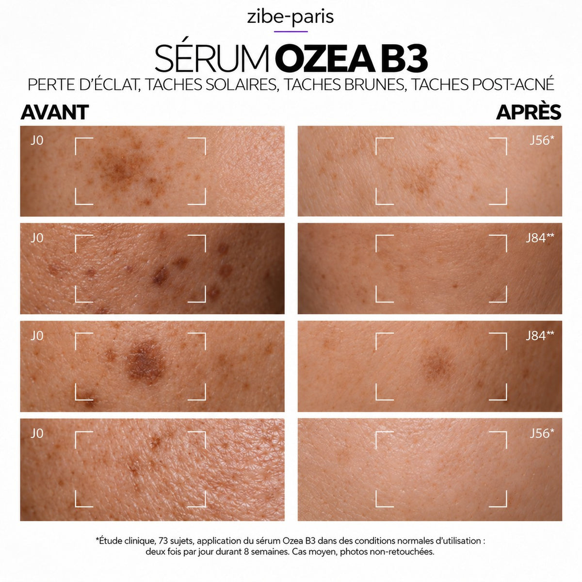 Sérum Anti-taches à la Vitamine B3